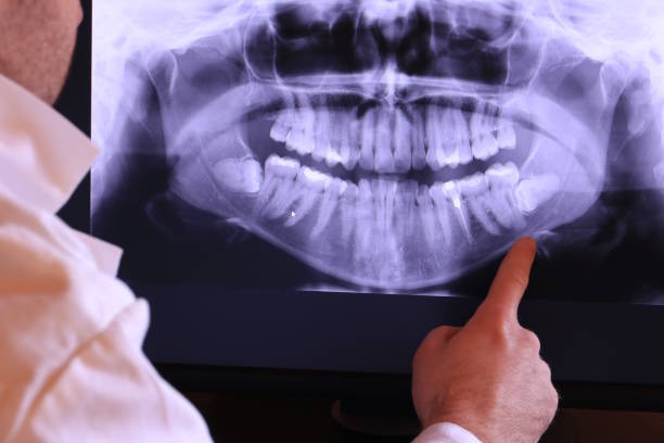 Best Emergency Treatment for Toothache in Kewaunee, WI
